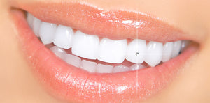 Open image in slideshow, GET ICEE&#39;D! Luxury Dental Gems (Read Instructions below)

