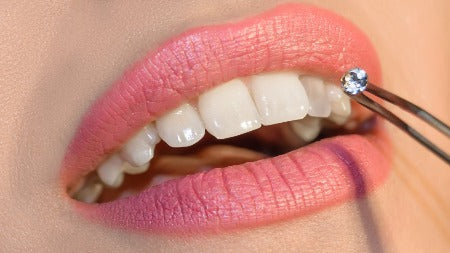 Tooth Gem Removal